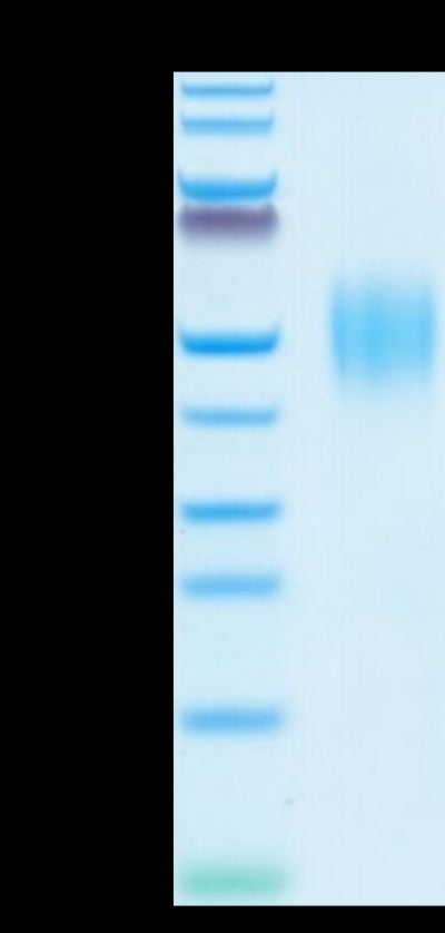 Human FGFR2 beta (IIIb) on Tris-Bis PAGE under reduced conditions. The purity is greater than 95%.