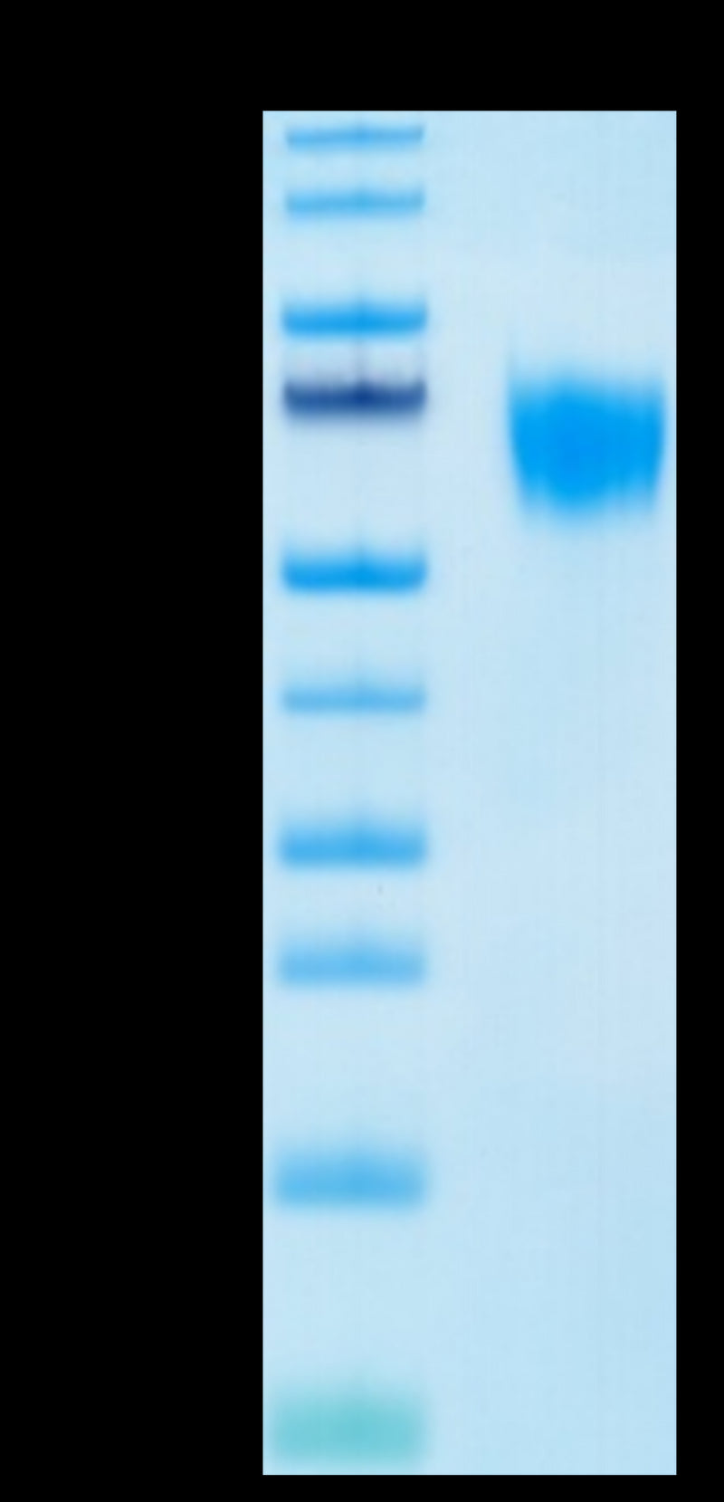 Biotinylated Human FGFR4 on Tris-Bis PAGE under reduced condition. The purity is greater than 95%.