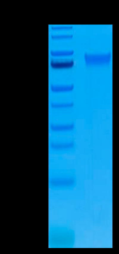 Biotinylated Human IL-6 R alpha on Tris-Bis PAGE under reduced condition. The purity is greater than 95%.