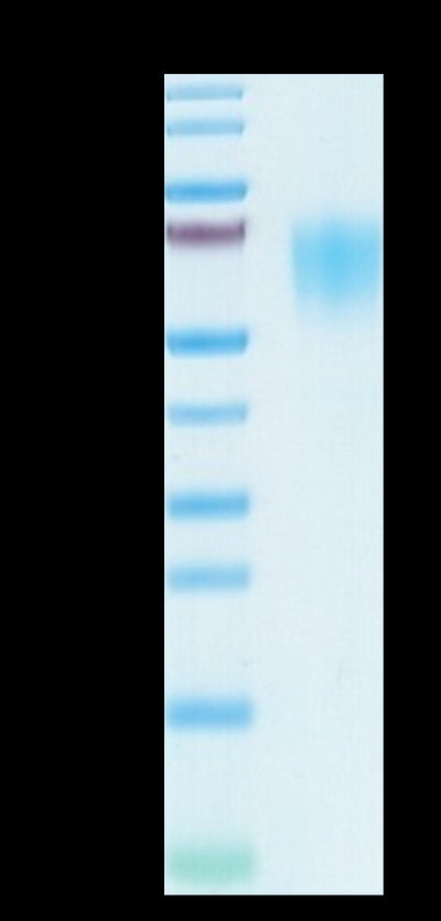 SARS-COV-2 Spike S1 NTD on Tris-Bis PAGE under reduced condition. The purity is greater than 95%.