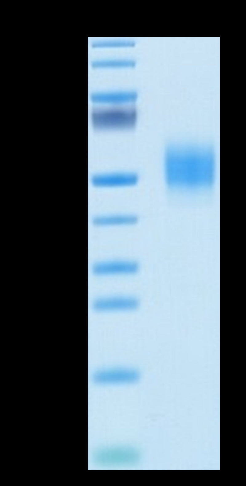 Biotinylated Human GFRAL on Tris-Bis PAGE under reduced conditions. The purity is greater than 95%.