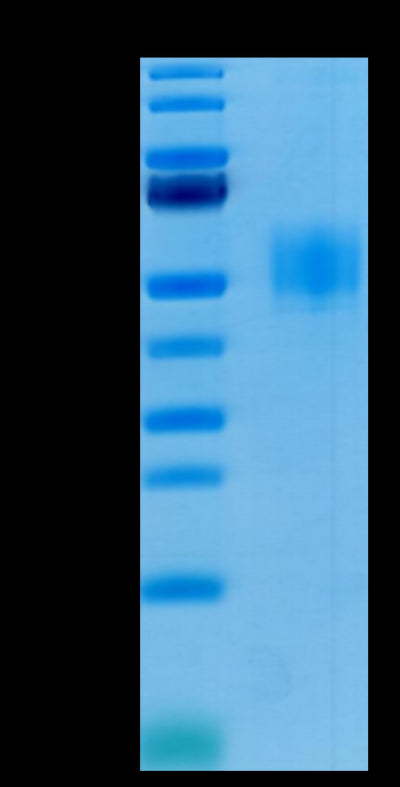 Human GFRAL on Tris-Bis PAGE under reduced condition.The purity is greater than 95%.