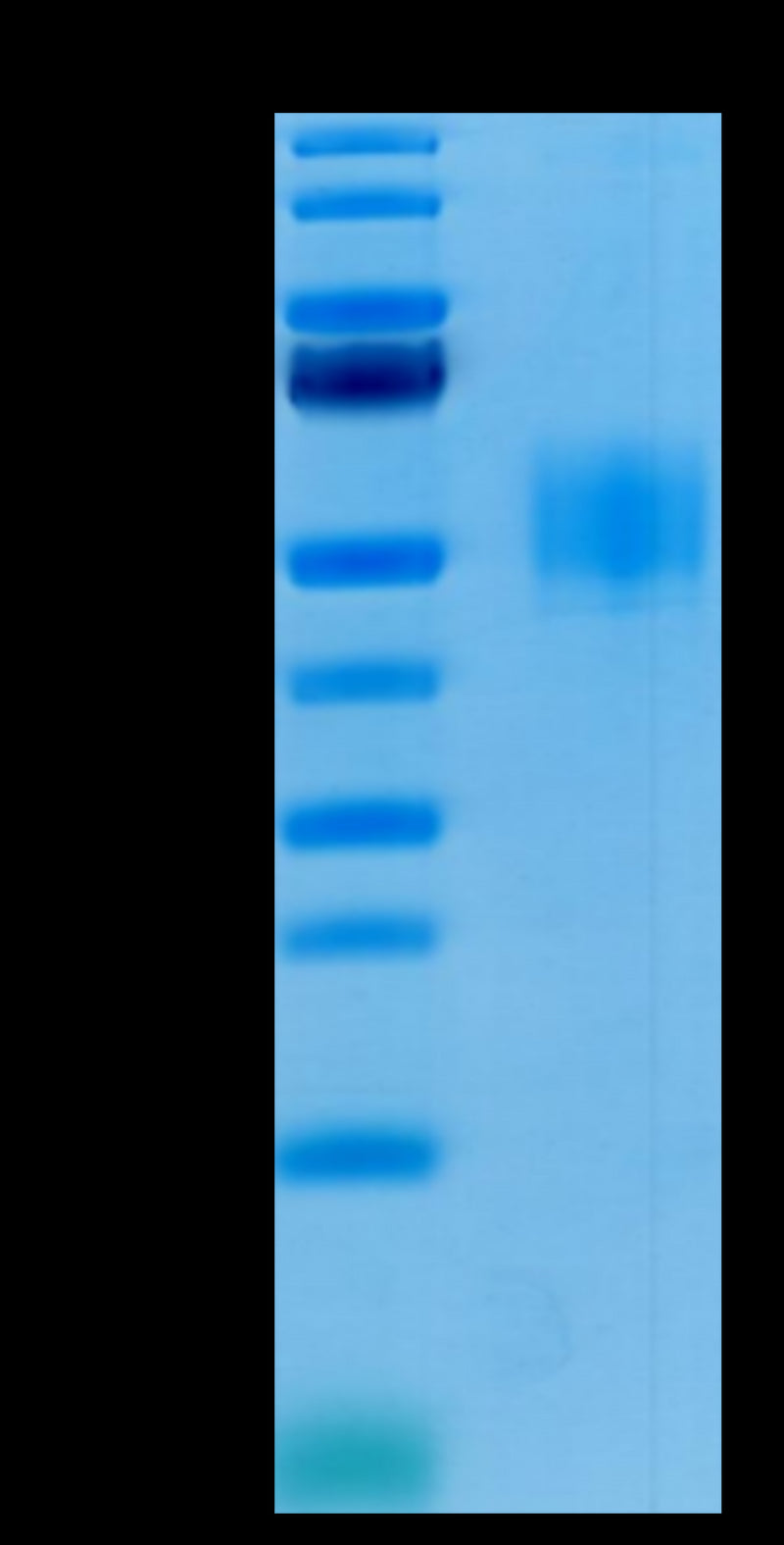 Human GFRAL on Tris-Bis PAGE under reduced condition.The purity is greater than 95%.