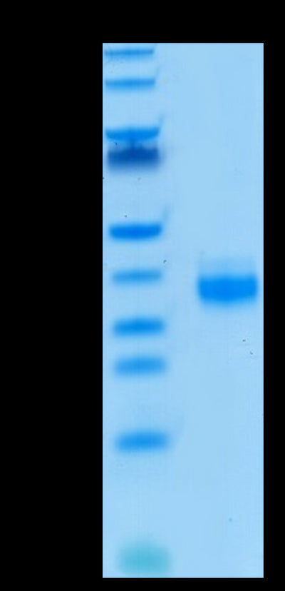 Biotinylated Human EpCAM on Tris-Bis PAGE under reduced condition. The purity is greater than 95%..