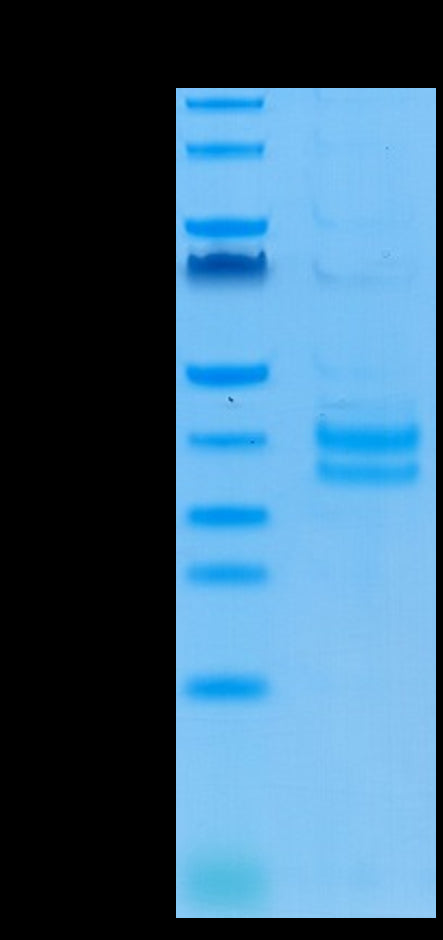 Cynomolgus/Rhesus macaque EpCAM on Tris-Bis PAGE under reduced condition. The purity is greater than 95%.