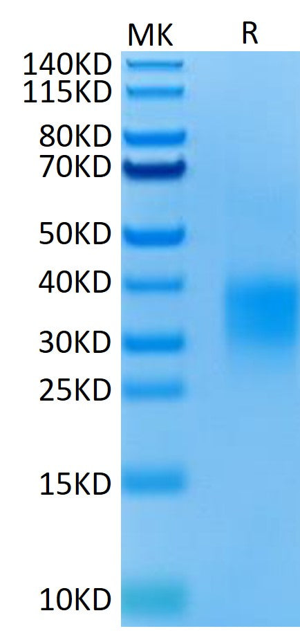 Mouse GITR on Tris-Bis PAGE under reduced condition. The purity is greater than 95%.