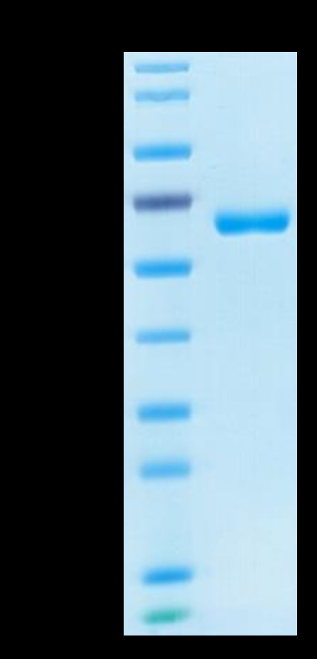 Human CD2 on Tris-Bis PAGE under reduced condition. The purity is greater than 95%.