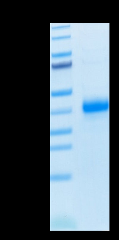 Human CD2 on Tris-Bis PAGE under reduced condition. The purity is greater than 95%.