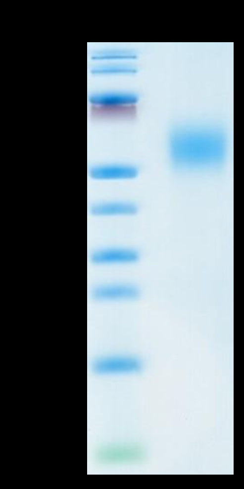 Human FGFR2 beta (IIIb) on Tris-Bis PAGE under reduced condition. The purity is greater than 95%.