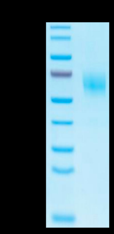 Biotinylated Human IL-1 Rrp2 on Tris-Bis PAGE under reduced condition. The purity is greater than 95%.