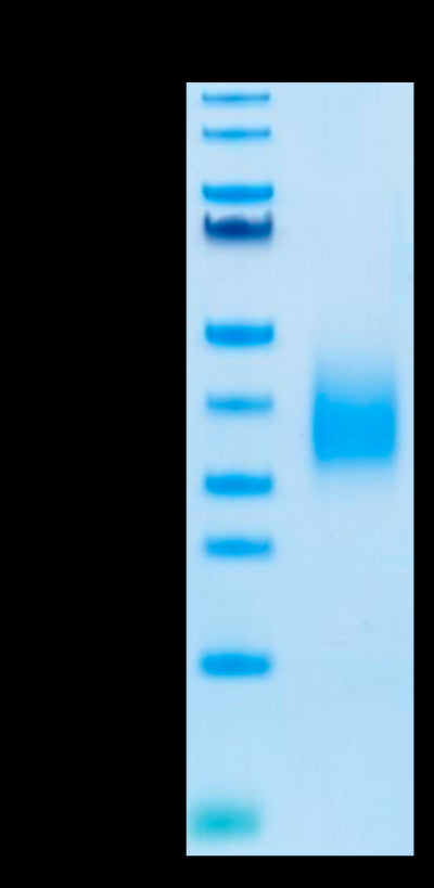 Biotinylated Human TREM2 on Tris-Bis PAGE under reduced condition. The purity is greater than 95%.