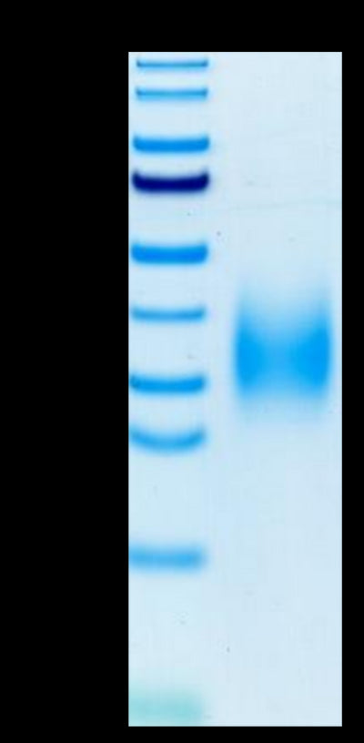 Human TREM2 on Tris-Bis PAGE under reduced condition. The purity is greater than 95%.