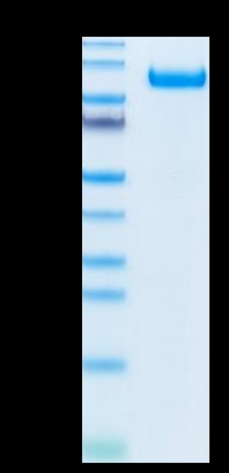 Biotinylated Rhesus macaque CDCP1 on Tris-Bis PAGE under reduced condition. The purity is greater than 95%.