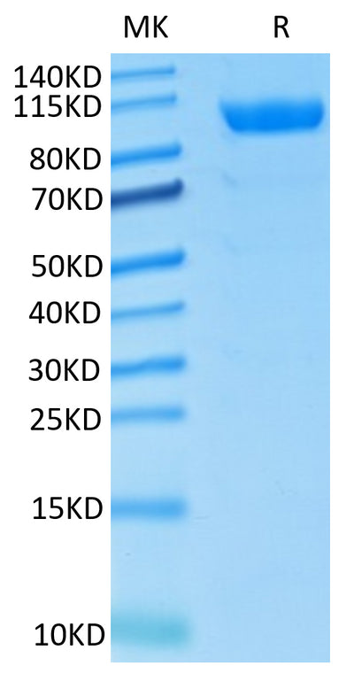 Rhesus macaque CDCP1 on Tris-Bis PAGE under reduced condition. The purity is greater than 95%..