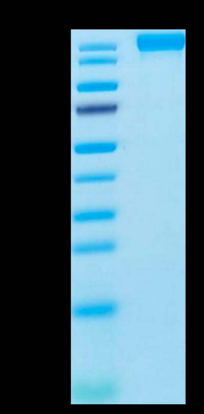 Human VEGF R2 on Tris-Bis PAGE under reduced condition. The purity is greater than 95%.