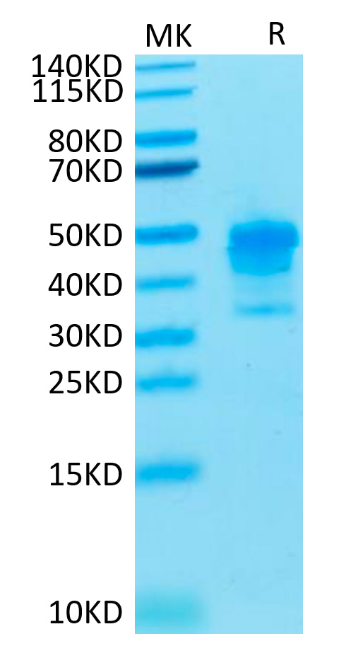 Cynomolgus MSLN on Tris-Bis PAGE under reduced condition. The purity is greater than 95%.