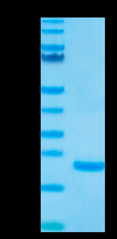 Biotinylated Human IL-10 on Tris-Bis PAGE under reduced condition. The purity is greater than 95%.