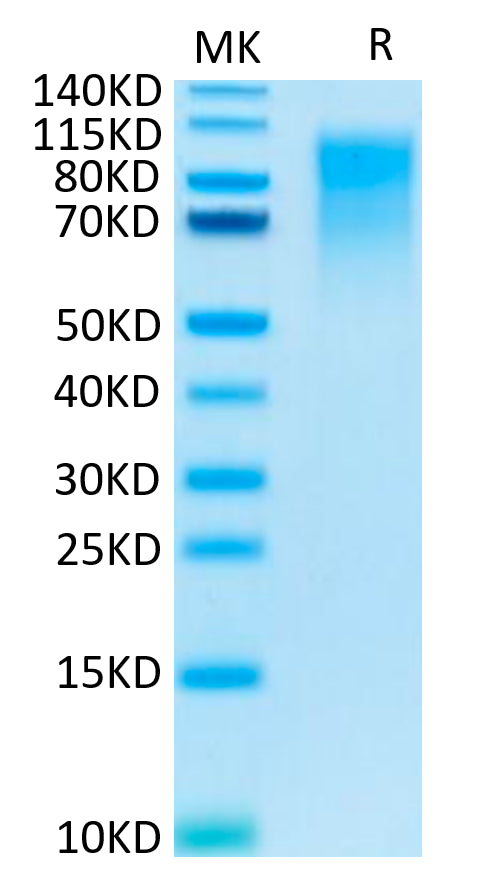 Human CEACAM-1 on Tris-Bis PAGE under reduced condition. The purity is greater than 95%.