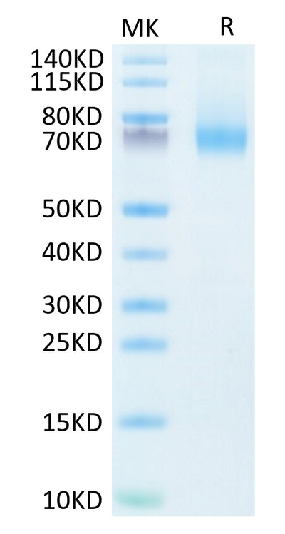 Human IL-7R alpha on Tris-Bis PAGE under reduced condition. The purity is greater than 95%.