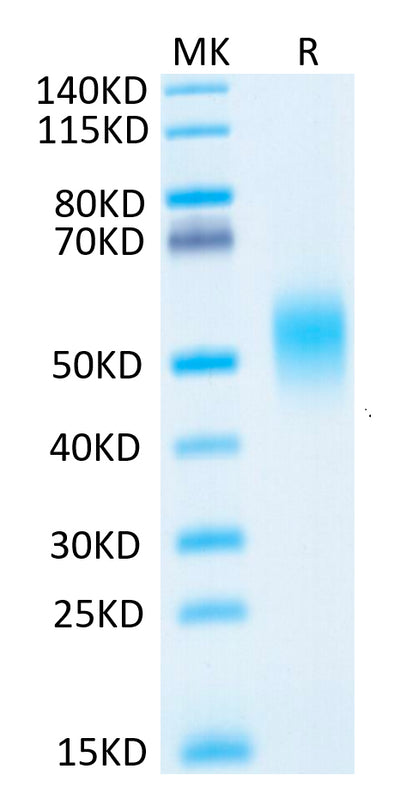 Human IL-7R alpha on Tris-Bis PAGE under reduced condition. The purity is greater than 95%.