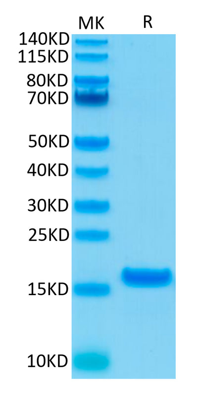 Human IL-21 on Tris-Bis PAGE under reduced condition. The purity is greater than 95%.