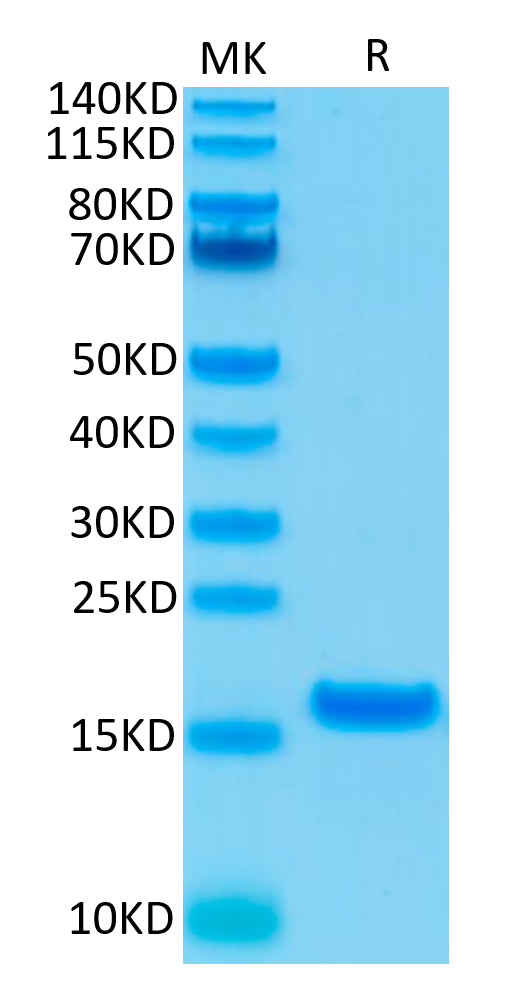 Human IL-21 on Tris-Bis PAGE under reduced condition. The purity is greater than 95%.