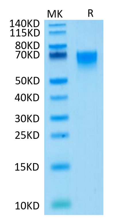 Human CD27/TNFRSF7 on Tris-Bis PAGE under reduced condition. The purity is greater than 95%.