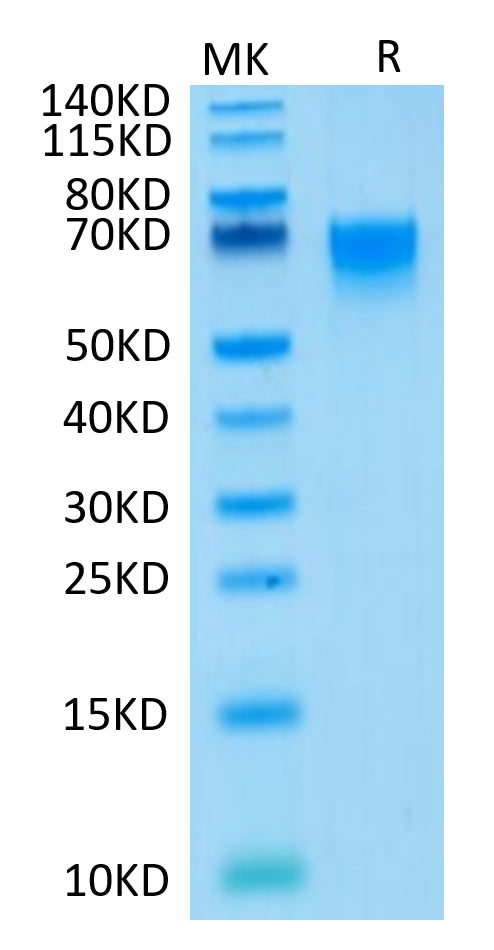 Human CD27/TNFRSF7 on Tris-Bis PAGE under reduced condition. The purity is greater than 95%.