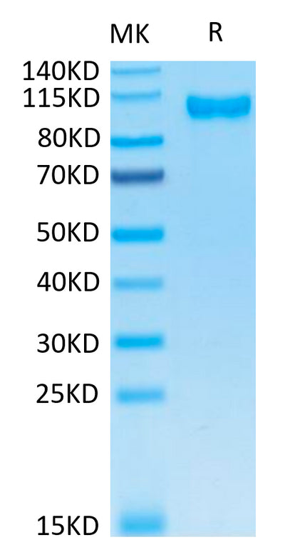 Human DPPIV on Tris-Bis PAGE under reduced condition. The purity is greater than 95%.