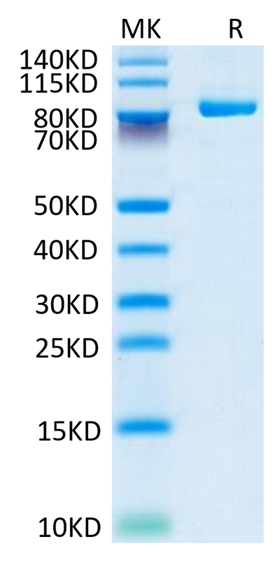 Biotinylated Cynomolgus FAP on Tris-Bis PAGE under reduced conditions. The purity is greater than 95%.