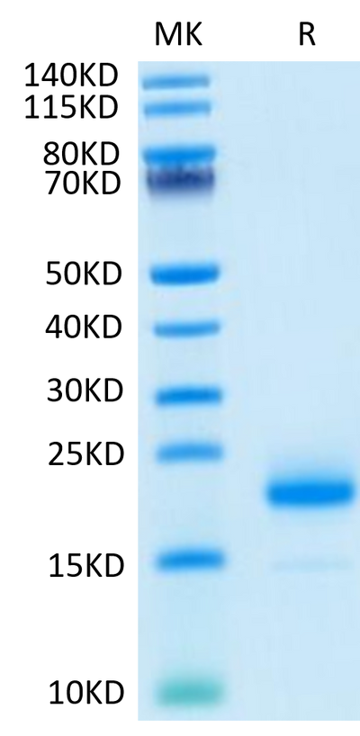 Human IL-4 on Tris-Bis PAGE under reduced condition. The purity is greater than 95%.