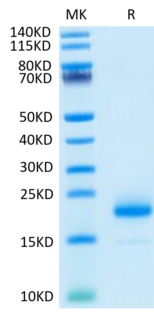 Human IL-4 on Tris-Bis PAGE under reduced condition. The purity is greater than 95%.