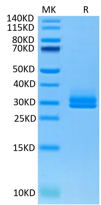 Human ANGPTL2 on Tris-Bis PAGE under reduced condition. The purity is greater than 95%.