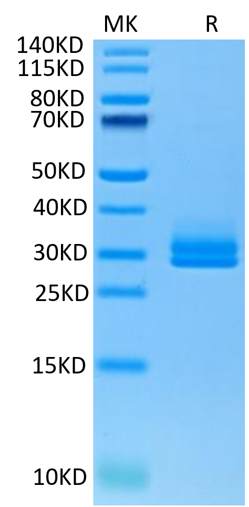 Human ANGPTL2 on Tris-Bis PAGE under reduced condition. The purity is greater than 95%.