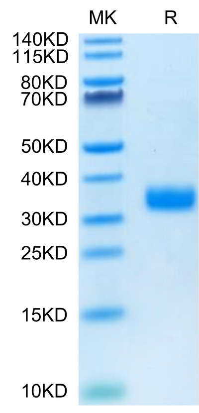 Human Angiopoietin-like 4 on Tris-Bis PAGE under reduced condition. The purity is greater than 95%.