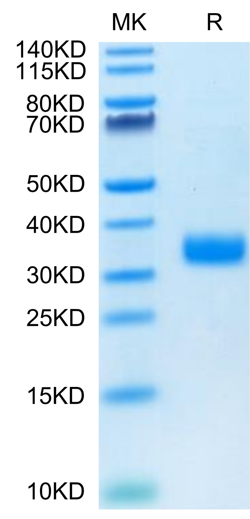 Human Angiopoietin-like 4 on Tris-Bis PAGE under reduced condition. The purity is greater than 95%.