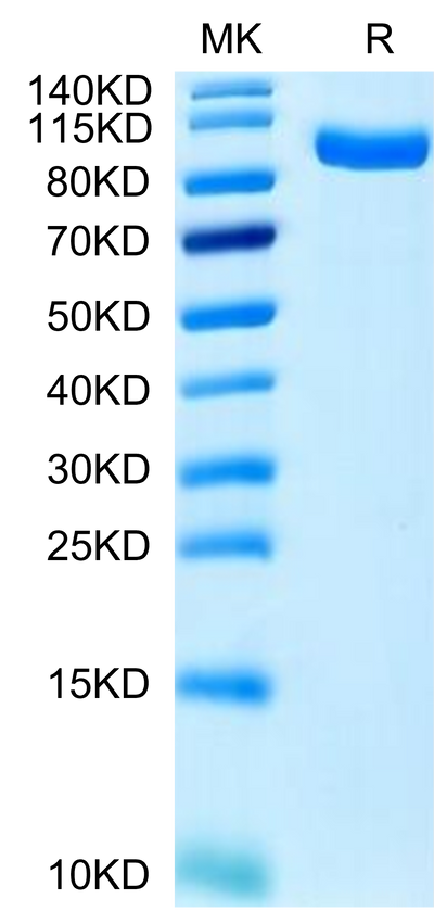 Human PTK7 on Tris-Bis PAGE under reduced condition. The purity is greater than 95%.