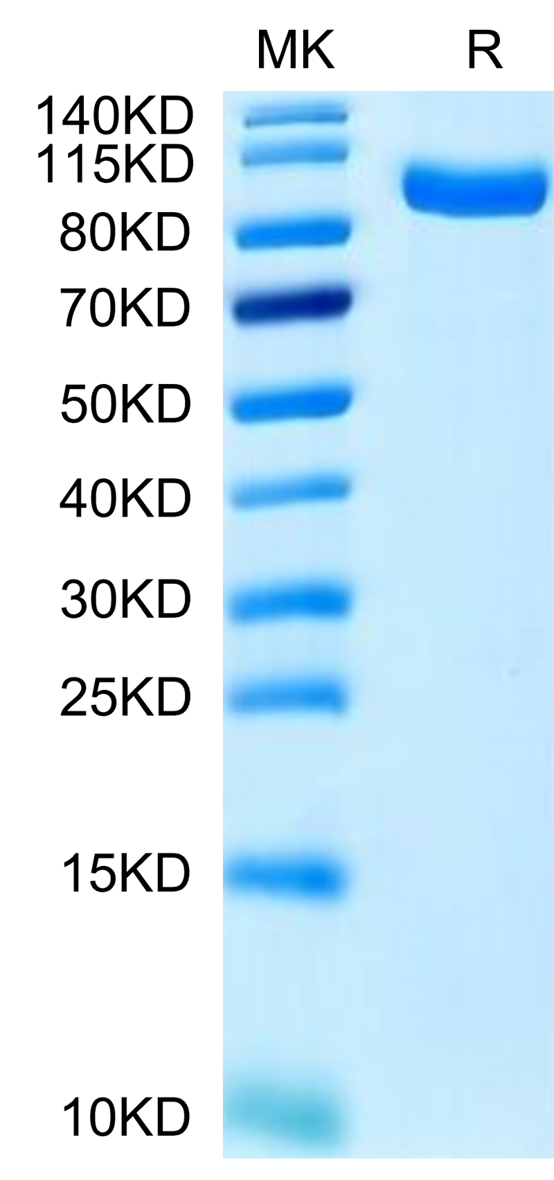 Human PTK7 on Tris-Bis PAGE under reduced condition. The purity is greater than 95%.