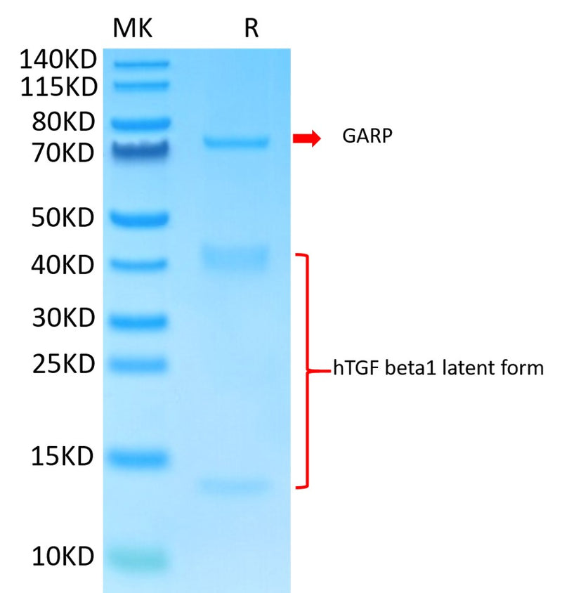 Biotinylated Human GARP&Latent TGF beta 1 Complex on Tris-Bis PAGE under reduced condition. The purity is greater than 95%.