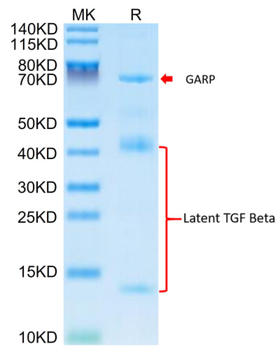 Mouse GARP&Latent TGF beta 1 Complex on Tris-Bis PAGE under reduced condition. The purity is greater than 95%.