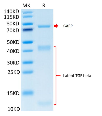 Cynomolgus GARP&Latent TGF beta 1 Complex on Tris-Bis PAGE under reduced condition. The purity is greater than 95%.