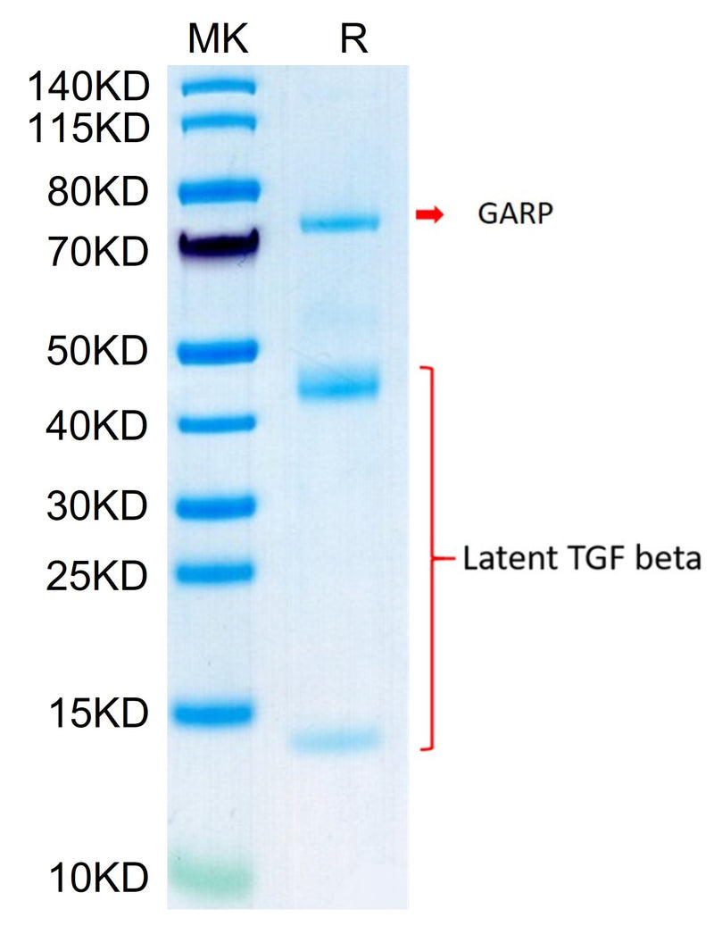 Biotinylated Mouse GARP&Latent TGF beta 1 Complex on Tris-Bis PAGE under reduced condition. The purity is greater than 95%.