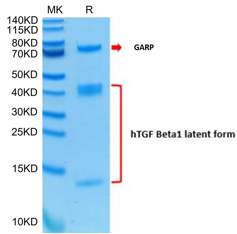 Human GARP&Latent TGF Beta 1 Complex on Tris-Bis PAGE under reduced condition. The purity is greater than 95%.