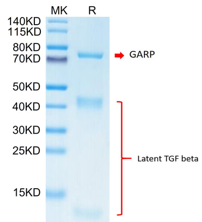 Biotinylated Cynomolgus GARP&Latent TGF beta 1 Complex on Tris-Bis PAGE under reduced condition. The purity is greater than 95%.