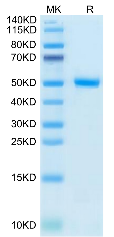 Human CD99 on Tris-Bis PAGE under reduced condition. The purity is greater than 95%.