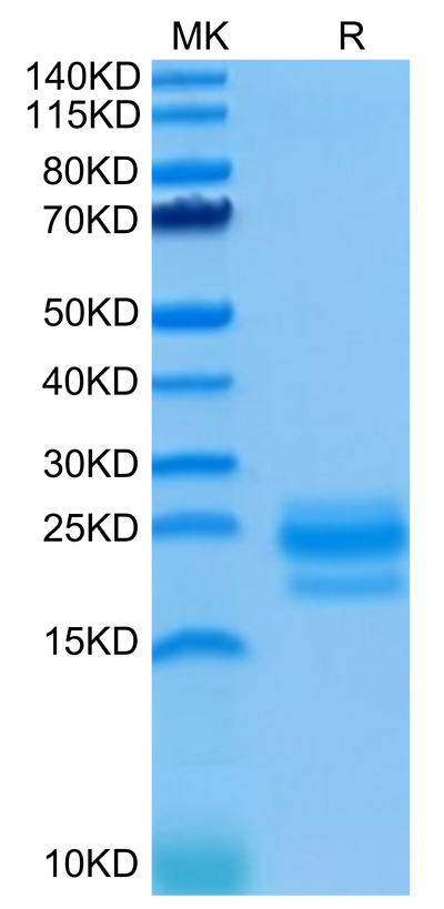 Human CD99 on Tris-Bis PAGE under reduced condition. The purity is greater than 95%.