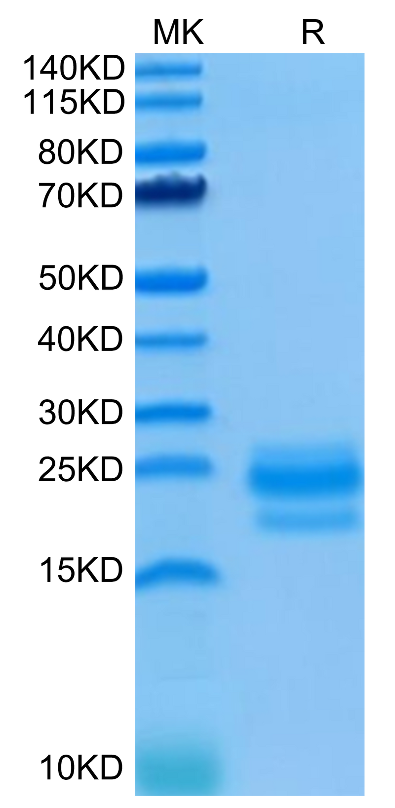 Human CD99 on Tris-Bis PAGE under reduced condition. The purity is greater than 95%.