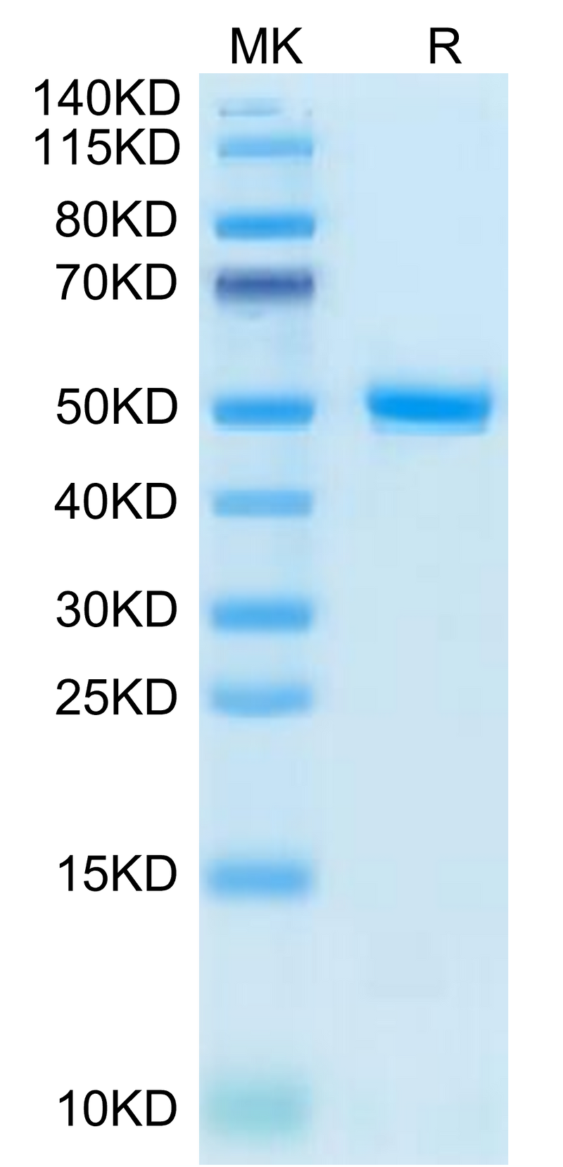 Human CD99 on Tris-Bis PAGE under reduced condition. The purity is greater than 95%.