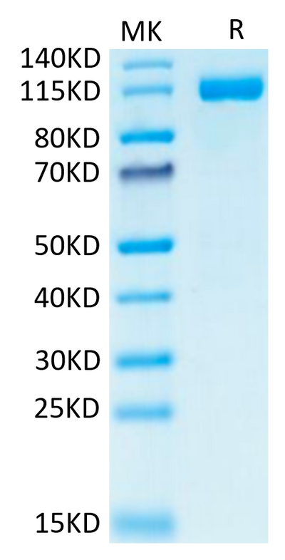 Human CD31 on Tris-Bis PAGE under reduced condition. The purity is greater than 95%.