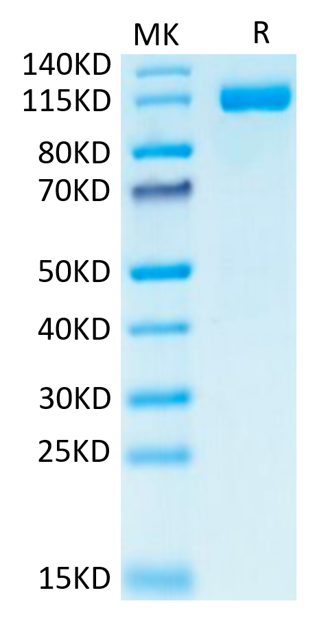 Human CD31 on Tris-Bis PAGE under reduced condition. The purity is greater than 95%.